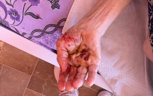 Mâna murdară de sânge și fecare a unei beneficiare din centrul „Casa Cora” din Voluntari.